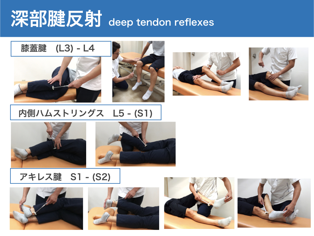 下肢の深部腱反射 Deep tendon reflexes 脊椎徒手療法研究所